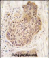 RIPK2 Antibody (C-term)