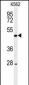 RIPK3 Antibody (C-term)