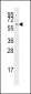 TGF Beta Receptor I Antibody (Center)