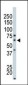 PAK4 Antibody (N-term)