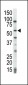 COT (MAP3K8/MEKK8) Antibody (C-term)