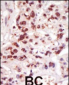 COT (MAP3K8/MEKK8) Antibody (C-term)