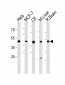 MEK2 (MAP2K2) Antibody (N-term)