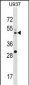 MEK2 (MAP2K2) Antibody (Center)