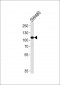 MAP3K9 Antibody (N-term)