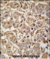 MYLK3 Antibody (N-term)