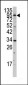 MYLK3 Antibody (N-term)