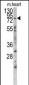 MYLK3 Antibody (N-term)