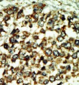 ATM Antibody (C-term)