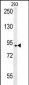 BRD2 Antibody (Center)