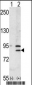 BRD2 Antibody (Center)