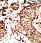BRD3 Antibody (C-term)