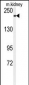 TRPM7 (CHAK1) Antibody (C-term)