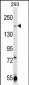 TRPM7 (CHAK1) Antibody (C-term)