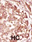 BUBR1 (BUB1B) Antibody (N-term)