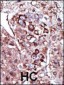 DGKZ Antibody (C-term)
