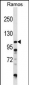 DGKZ Antibody (C-term)