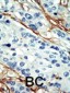 ARK5 Antibody (C-term)