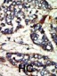 NEK1 Antibody (C-term)