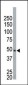 NEK2 Antibody (Center)