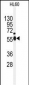 NEK2 Antibody (Center)