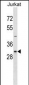 NEK7 Antibody (N-term)