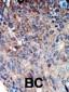 NM23 (NME1) Antibody (N-term)