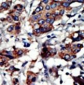 PACSIN3 Antibody (N-term)