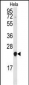 PBP Antibody (N-term)