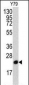 PBP Antibody (N-term)