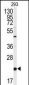 PBP Antibody (Center)