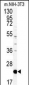 PBP Antibody (Center)