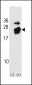 PBP Antibody (Center)