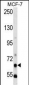 PCK1 Antibody (N-term)