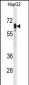 PCK2 Antibody (N-term)