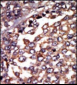 Protein Kinase A regulatory subunit I alpha Antibody (N-term)