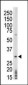 PRPK Antibody (Center)