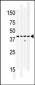 WNK1 Antibody (Center)