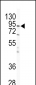 IKK beta Antibody