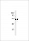 p53 Antibody (Sumoylation Site Specific)
