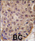 OAS1 Antibody (C-term)