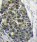 LRP6 Antibody (C-term T1546)