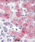 SYVN1 (HRD1) Antibody (C-term)