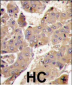 PIK3R3 Antibody (C-term)