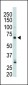 PIP5KI gamma (PIP5K1G) Antibody (N-term)