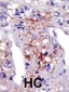 PIP5KI gamma (PIP5K1G) Antibody (N-term)
