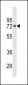 PIP5KI gamma (PIP5K1G) Antibody (C-term)