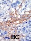 PIP5KI gamma (PIP5K1G) Antibody (C-term)