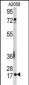 UBC9 (UBE2I) Antibody (N-term)