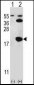 UBC9 (UBE2I) Antibody (N-term)